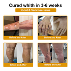 DR.HONOR® All-In-One Joint & Bone Recovery Cream🎉🎉(Specially for older adults)