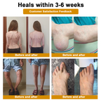 DR.HONOR® All-In-One Joint & Bone Recovery Cream🎉🎉(Specially for older adults)